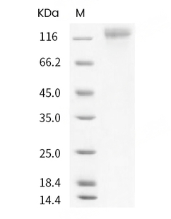 Human coronavirus HKU1 (isolate N1) (HCoV-HKU1) Spike S1 Protein (His)