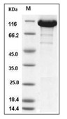 ATP citrate lyase/ACLY Protein, Human, Recombinant (His)