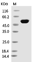 Influenza A H3N2 (A/Hong Kong/2671/2019) Nucleoprotein/NP Protein (His)