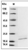 IL-10 Protein, Human, Recombinant (His)