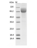 CD36 Protein, Human, Recombinant (His)