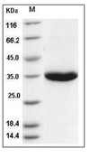 Kallikrein 3/KLK3 Protein, Human, Recombinant (His)