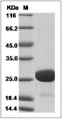HIV-1 (group M, subtype B, strain HXB2) p24 Protein (His)