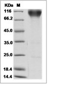 FGFR2 Protein, Human, Recombinant (alpha IIIb, hFc)