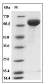 Influenza A H1N1 (A/Beijing/22808/2009) Hemagglutinin/HA Protein (His)