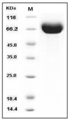 Influenza A H9N2 (A/Hong Kong/1073/99) Hemagglutinin/HA Protein (His)