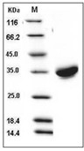 CXADR/CAR Protein, Human, Recombinant (His)