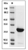Histone H1 Protein, Human, Recombinant (His)