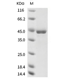Human coronavirus (HCoV-NL63) Nucleocapsid Protein (His)