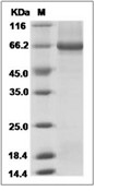 Alkaline Phosphatase/PLAP Protein, Human, Recombinant (His)