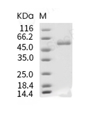 TSHR Protein, Human, Recombinant (His)