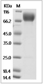 IL-18R alpha Protein, Mouse, Recombinant (mFc)