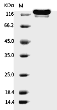 TIE2 Protein, Human, Recombinant (His & hFc)