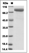FAP Protein, Cynomolgus, Recombinant (His)