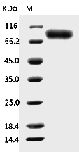 IL-2RG Protein, Mouse, Recombinant (His & hFc)
