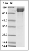 IL-18R alpha Protein, Human, Recombinant (hFc)