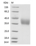 TREM-1 Protein, Human, Recombinant (His)