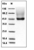 Decorin Protein, Human, Recombinant (His)