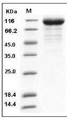 Influenza A H3N2 (A/Brisbane/10/2007) Hemagglutinin/HA Protein (His)