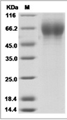 Influenza B (B/PHUKET/3073/2013) Hemagglutinin/HA1 Protein (His)