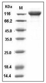gp130/IL6ST Protein, Human, Recombinant (His & hFc)