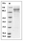 Iduronate 2 sulfatase/IDS Protein, Human, Recombinant (His)