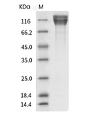 CEACAM5 Protein, Human, Recombinant (His)