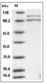 Ku70 & Ku80 Heterodimer Protein, Human, Recombinant (His)