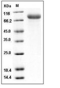Endoglin/CD105 Protein, Human, Recombinant (His)