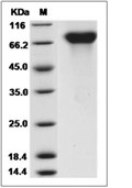 Protein S/PROS1 Protein, Human, Recombinant (His)