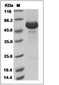 RANK/TNFRSF11A Protein, Human, Recombinant (hFc)