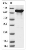 KEAP1 Protein, Human, Recombinant (His & GST & Avi)