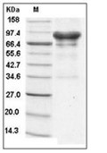 Carbonic Anhydrase 9 Protein, Human, Recombinant (hFc)