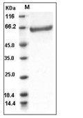 Coagulation factor XIII B/F13B  Protein, Human, Recombinant (His)