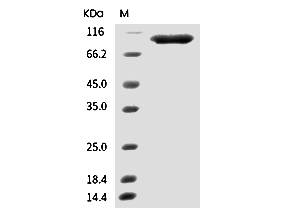 SARS-CoV-2 RNA-dependent RNA polymerase/RDRP Protein (His)