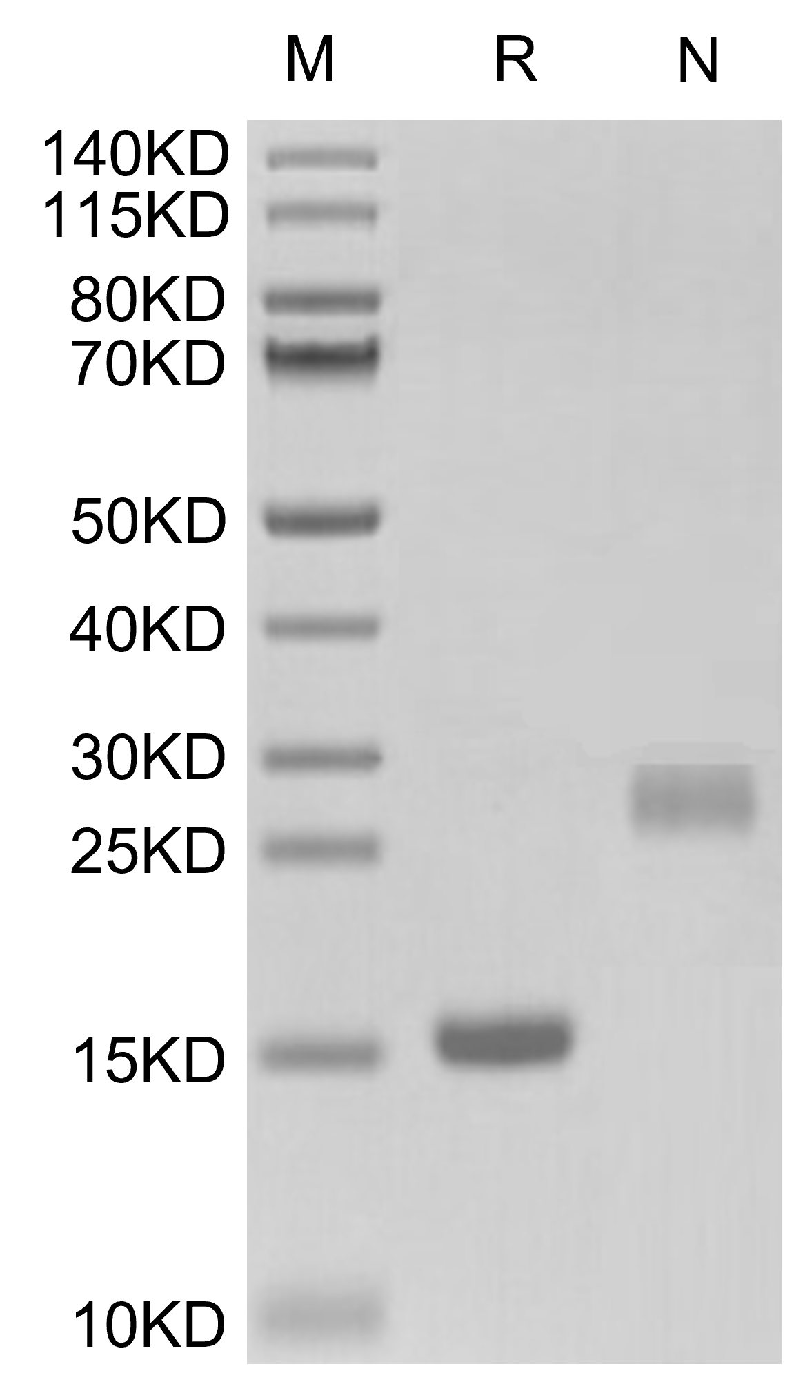 GDF-15 Protein, Mouse, Recombinant (His)