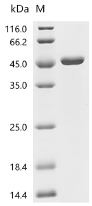 Measles virus (MeV) (strain Edmonston-Schwarz vaccine) Nucleoprotein/NP Protein (E. coli, His)