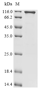 HK1 Protein, Human, Recombinant (His)