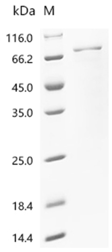NR4A1 Protein, Human, Recombinant (His & Myc)