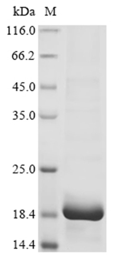 Hemicentin-1 Protein, Human, Recombinant (His)