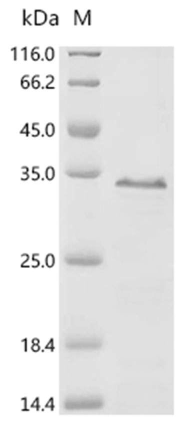 Epstein-Barr virus (strain AG876) LMP1 Protein (His & Myc)