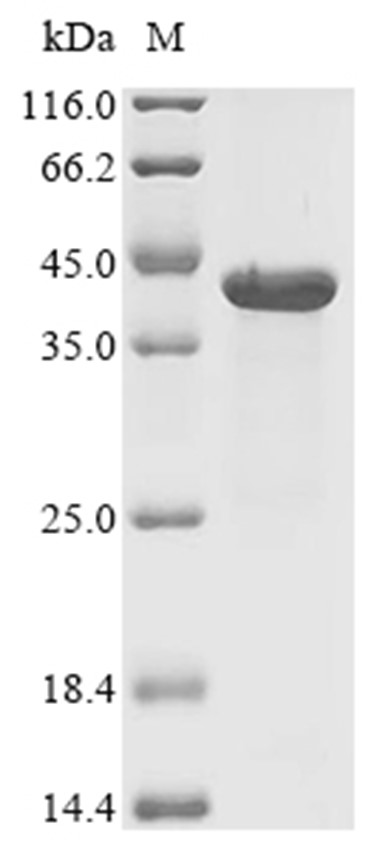 OmpC Protein, E. coli, Recombinant (His)