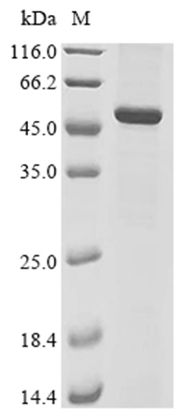 DCP2 Protein, Human, Recombinant (His)