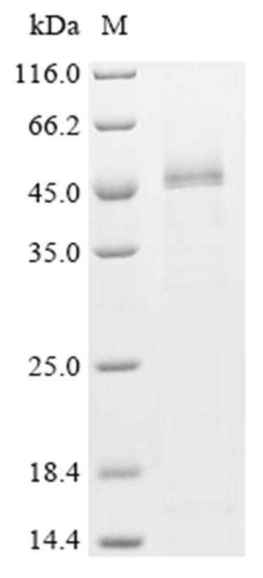 Serpin A3K Protein, Mouse, Recombinant (His)