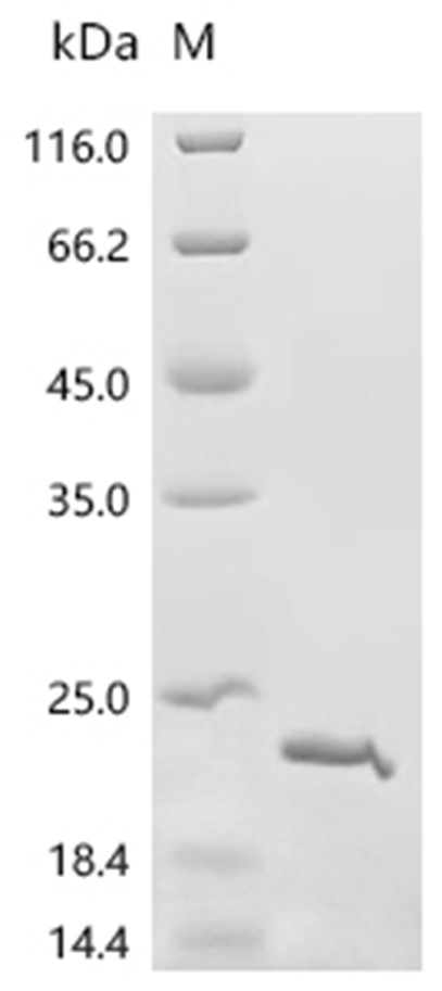 VCAN Protein, Mouse, Recombinant (His & Myc)