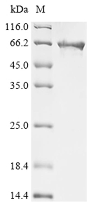 Perfringolysin O Protein, Clostridium perfringens, Recombinant (His & SUMO)