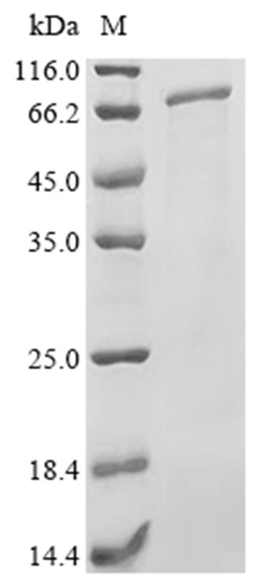 Serralysin Protein, Proteus mirabilis, Recombinant (His & SUMO)