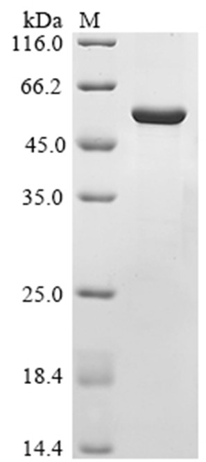 Lys-gingipain Protein, Porphyromonas gingivalis, Recombinant (His & SUMO)