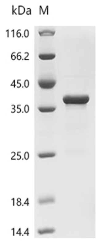 Invasin Protein, Yersinia enterocolitica, Recombinant (His & SUMO)