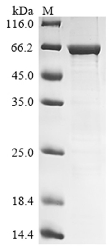 CCHF virus (isolate C68031) Nucleoprotein/NP Protein (B2M & His)